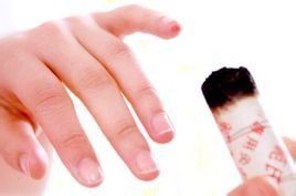 艾灸療法 艾灸療法