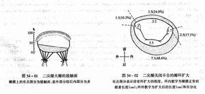 二尖瓣脫垂綜合症