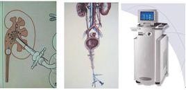 超聲引導細針穿刺組織學活檢 超聲引導細針穿刺組織學活檢