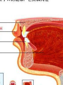 扁桃體腫大 扁桃體腫大