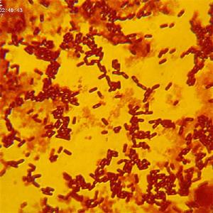 黏乳產鹼桿菌 黏乳產鹼桿菌