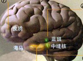 髓鞘化延遲 髓鞘化延遲