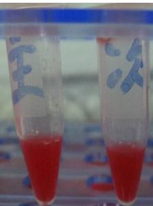 交叉配血試驗 交叉配血試驗