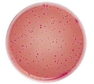 腸菌群最近似數 腸菌群最近似數