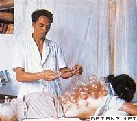 《拔罐法》
