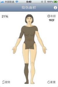 燒傷面積 燒傷面積