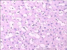 councilman小體 councilman小體