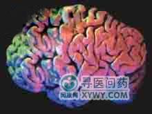 顱內海綿狀血管瘤 顱內海綿狀血管瘤