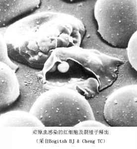 瘧原蟲感染的紅細胞及裂殖子釋出