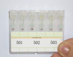 冷凝集素綜合徵