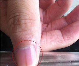 藍新月甲 藍新月甲