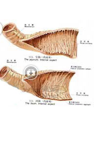 偽膜性腸炎 偽膜性腸炎