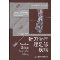 針刀治療踝足部疾病 針刀治療踝足部疾病