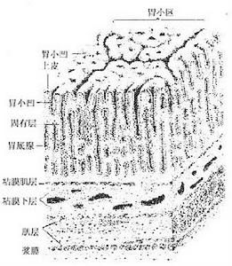 小兒嘔吐--腸梗阻