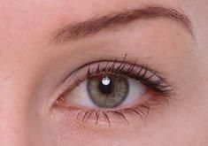 雙眼皮修復 雙眼皮修復