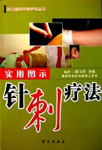 實用圖示針刺療法