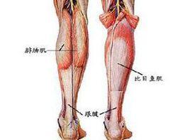 腓腸肌壓痛 腓腸肌壓痛