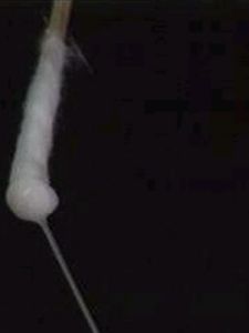 白帶過多 白帶過多