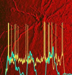 內嗅皮層活躍區域