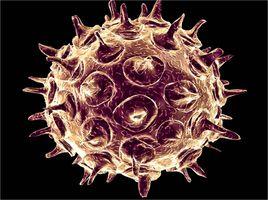 水痘-帶狀皰疹病毒
