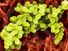 金黃色葡萄球菌