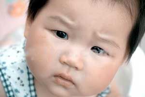 多灶性運動神經病