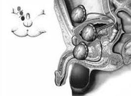 血清睪酮濃度低下 血清睪酮濃度低下