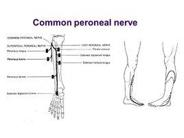 腓總神經 腓總神經