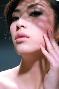 化妝品過敏 化妝品過敏