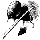 扁桃體周圍膿腫