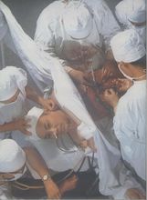 針刺麻醉開胸手術