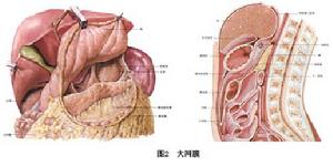 小網膜囊疝 圖2
