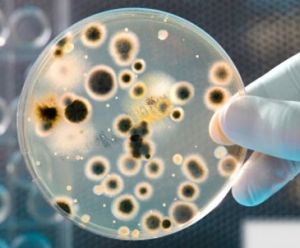 前列腺顆粒細胞 前列腺顆粒細胞