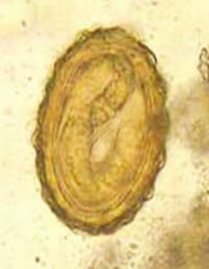 似蚓蛔線蟲 似蚓蛔線蟲