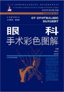 眼科手術圖解 眼科手術圖解