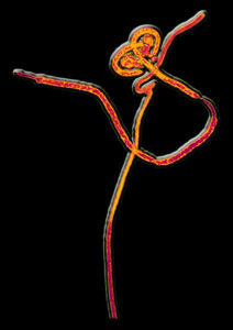 絲狀病毒 絲狀病毒