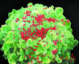 （圖）感染HIV的T細胞（紅色為HIV病毒，綠色為宿主細胞)