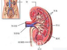 （圖）小兒紫癜性腎炎