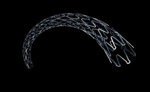 三氧化二砷支架系統 三氧化二砷支架系統