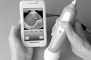 	MOBIUS SP1超聲系統 