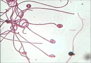 諾卡氏放線菌 諾卡氏放線菌