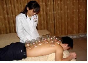 拔罐療法