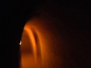 幽閉綜合症 幽閉綜合症