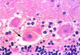 Negri小體 Negri小體