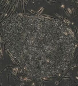 成熟細胞再編程技術 成熟細胞再編程技術