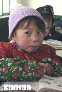 冷凝集素綜合徵