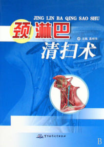 頸淋巴清掃術 頸淋巴清掃術