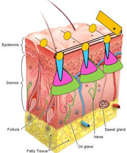 表皮剝脫素 表皮剝脫素