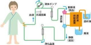 血液透析併發症
