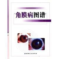 《角膜病圖譜》 《角膜病圖譜》